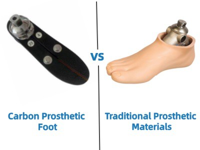 Προσθετικό Πόδι από Ίνες Άνθρακα εναντίον Παραδοσιακών Προσθετικών Υλικών